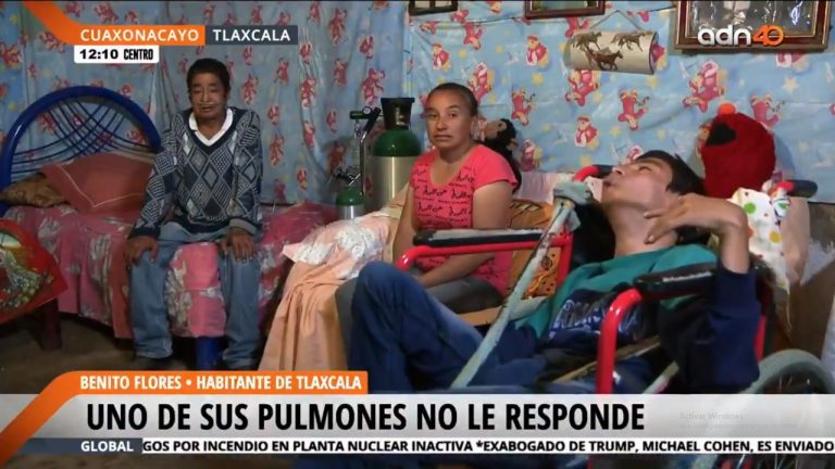Con un hijo con parálisis, su esposo enfermo y sin trabajo, Araceli no puede más con la pandemia