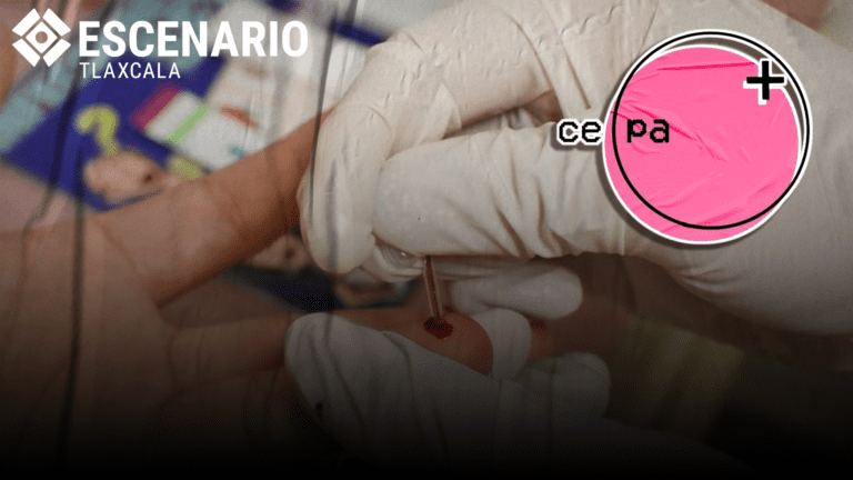 CEPA un lugar seguro para las personas con VIH en Tlaxcala